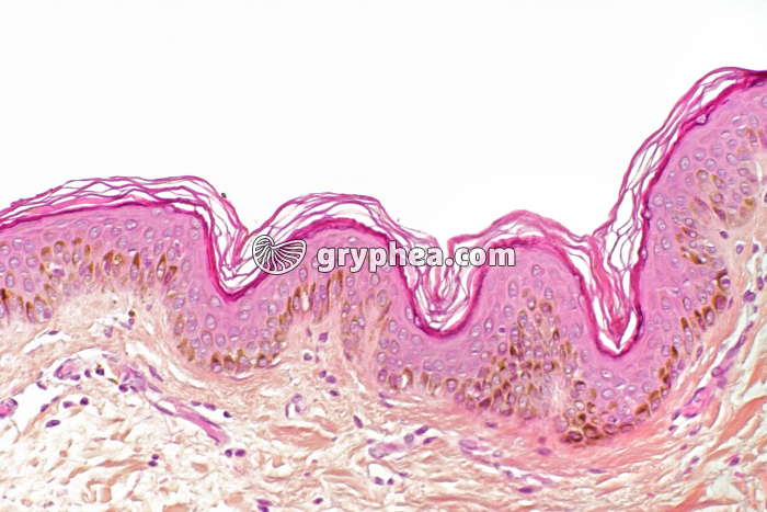 Peau race noire CT x70 - gryphea.org